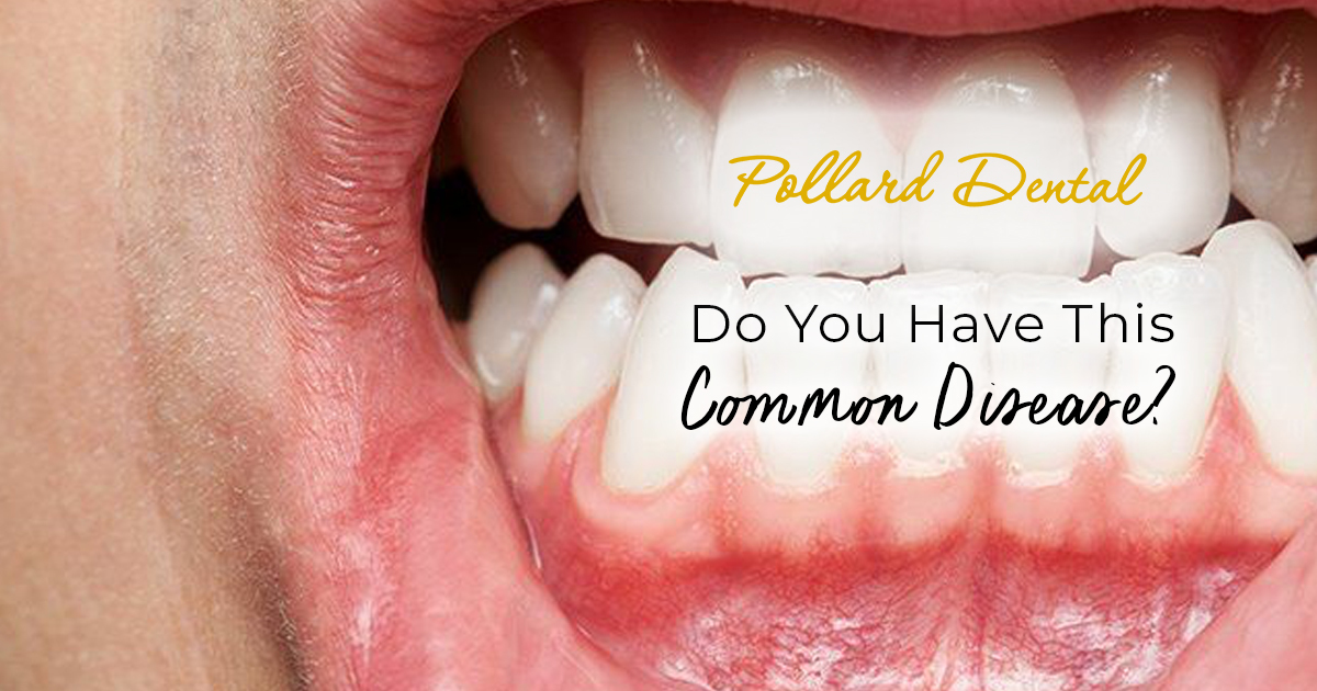 pollard – blog – may – 1200×630 – V1