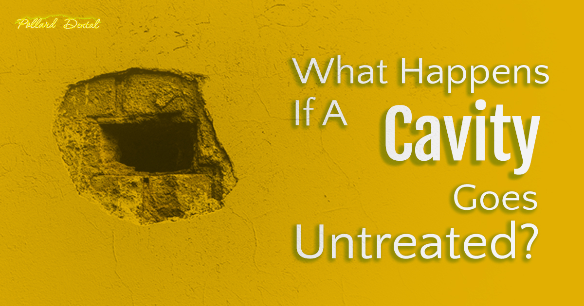 Pollard_Email-March-24