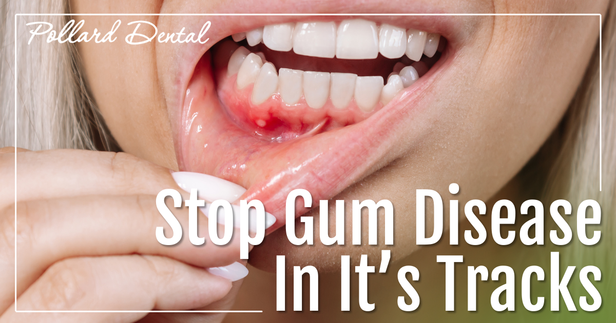 Pollard Email September 2025