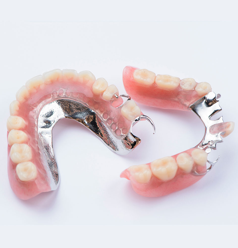 Partial Dentures