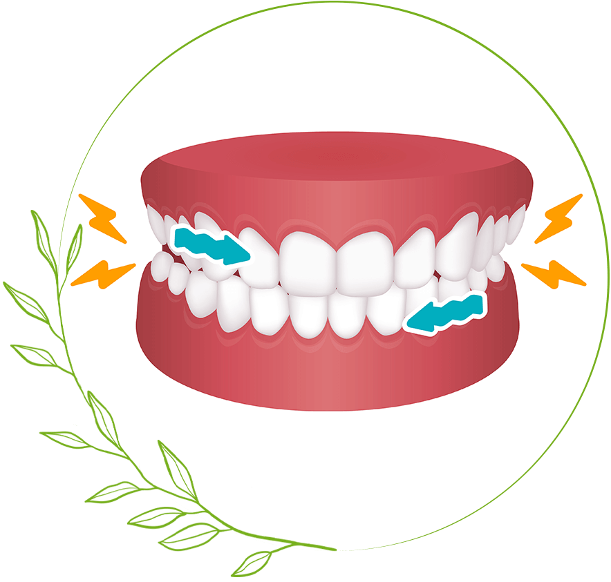 Grinding teeth