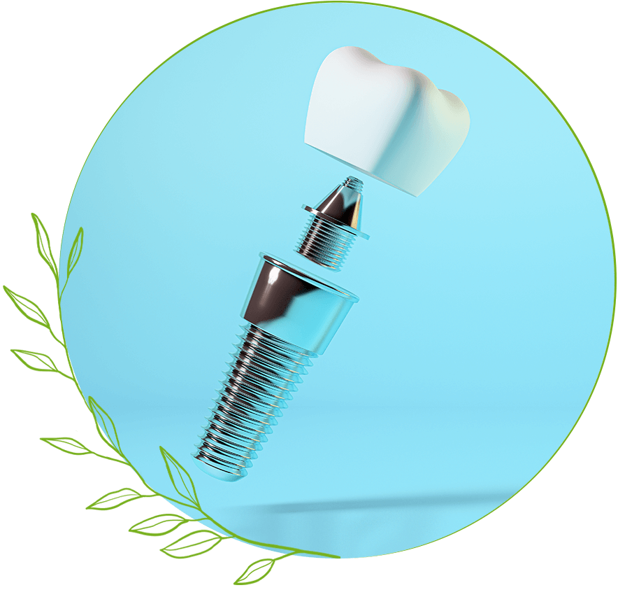dental implant
