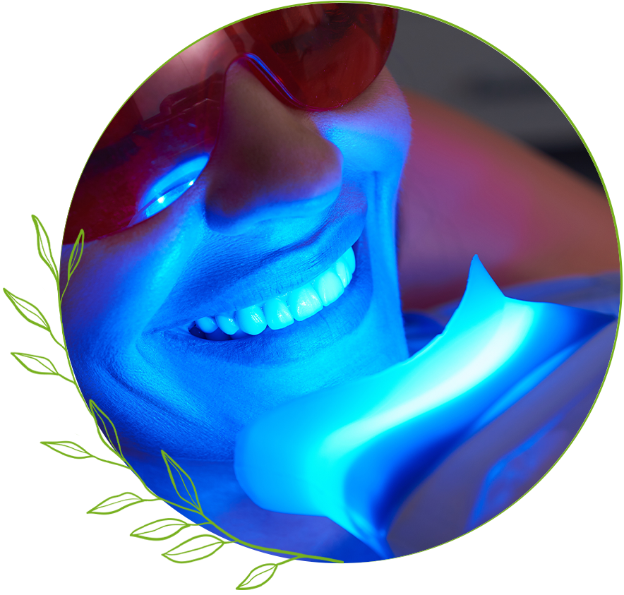 Patient Having their teeth Whitening